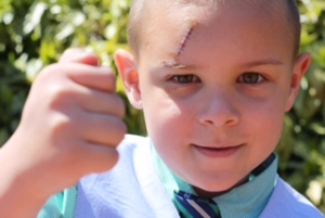 boy with stitches